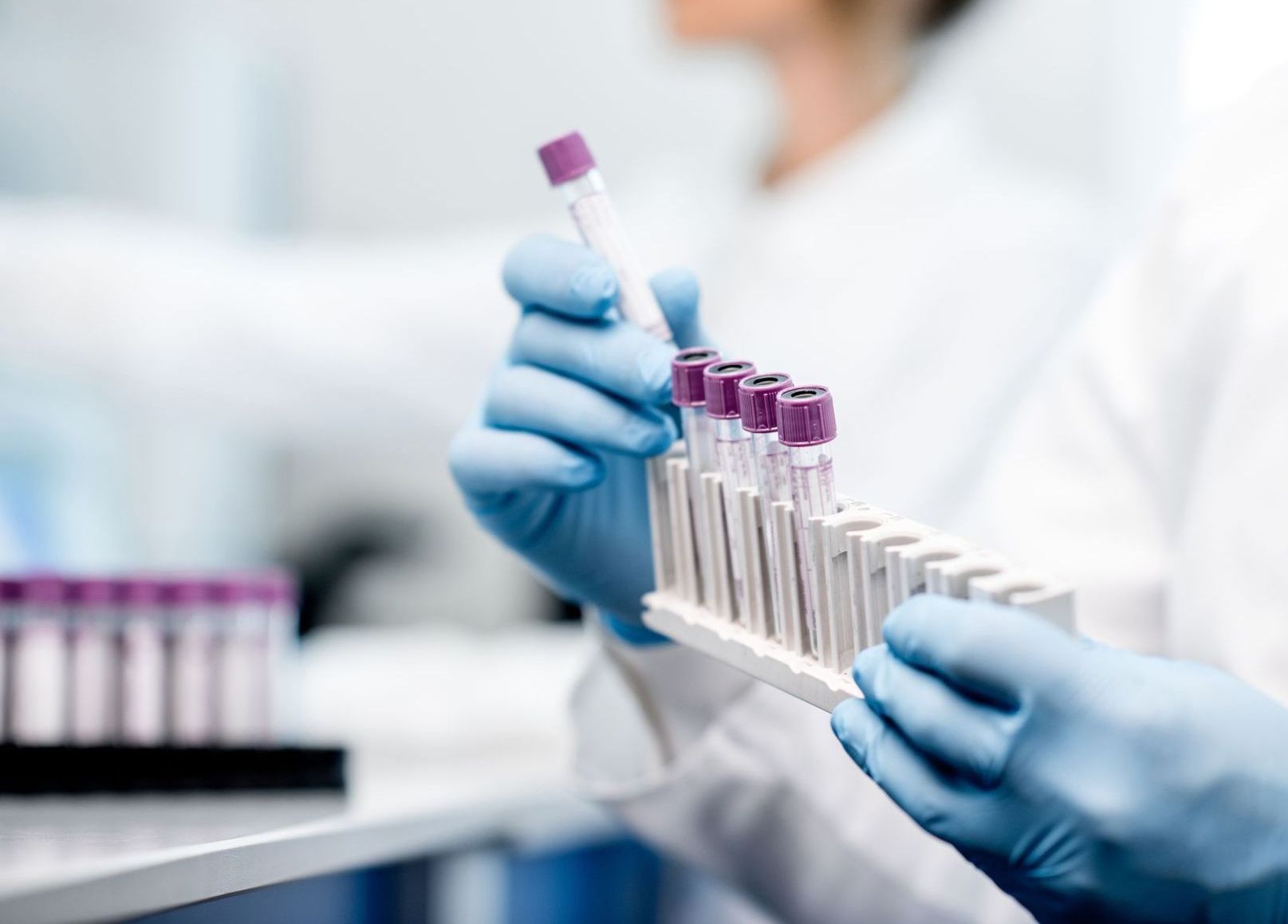 closeup of medical lab technician holding test tube rack
